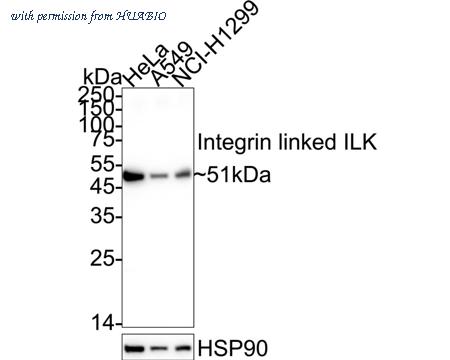 HUABIO ET1610-76 image 2