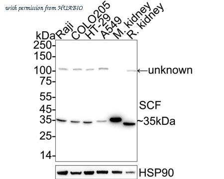 HUABIO ET1610-77 image 1