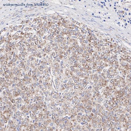 HUABIO ET1610-77 image 2