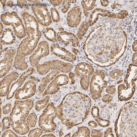 HUABIO ET1610-77 image 3