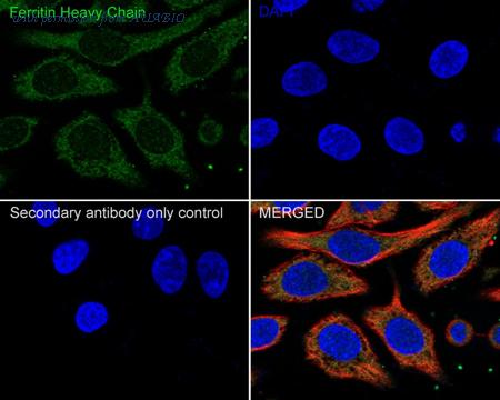 HUABIO ET1610-78-50UL image 3