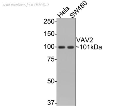 HUABIO ET1610-79 image 1