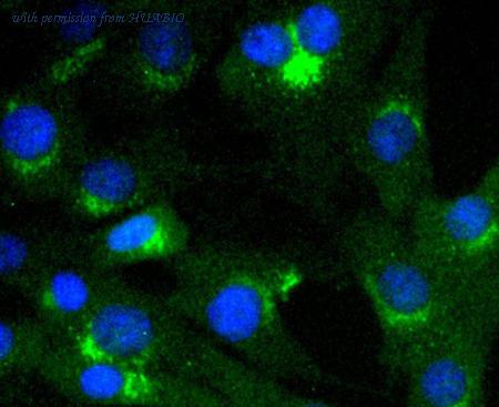 HUABIO ET1610-79 image 3