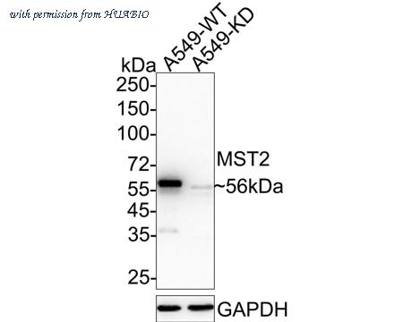 HUABIO ET1610-8 image 1