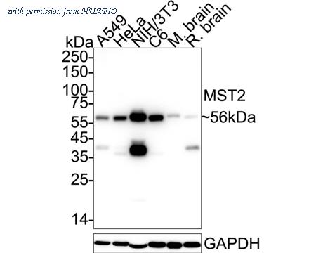 HUABIO ET1610-8 image 2