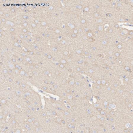 HUABIO ET1610-80 image 3