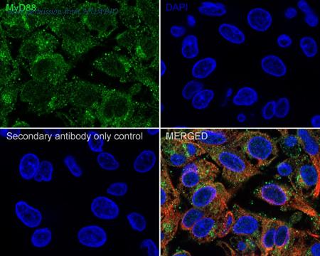 HUABIO ET1610-81 image 2