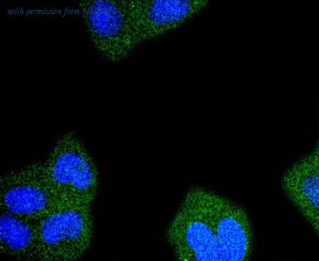 HUABIO ET1610-83 image 2