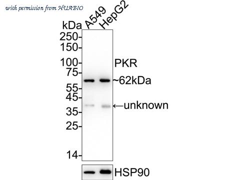 HUABIO ET1610-84 image 1