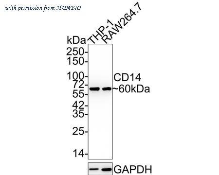 HUABIO ET1610-85-50UL image 1