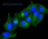 HUABIO ET1610-86-50UL image 1