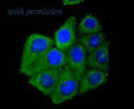 HUABIO ET1610-86-50UL image 2