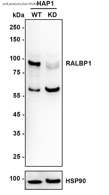 HUABIO ET1610-88 image 2