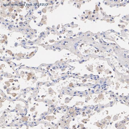 HUABIO ET1610-88 image 3