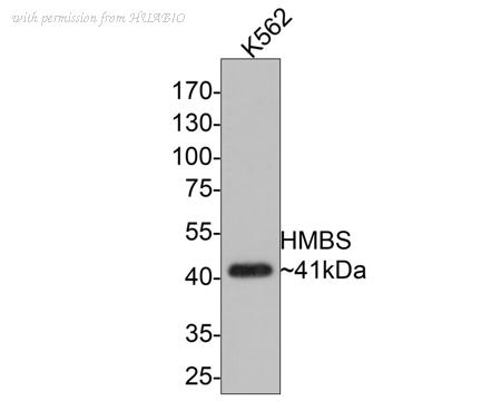 HUABIO ET1610-91 image 2