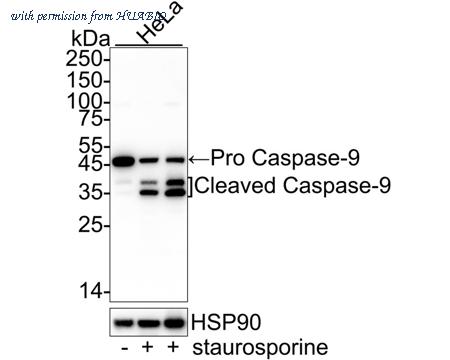 HUABIO ET1610-95 image 1