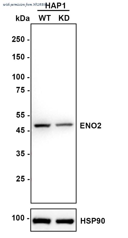 HUABIO ET1610-96 image 2