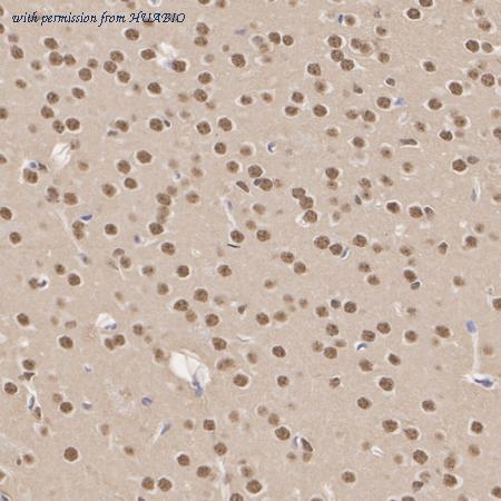 HUABIO ET1610-97-50UL image 3