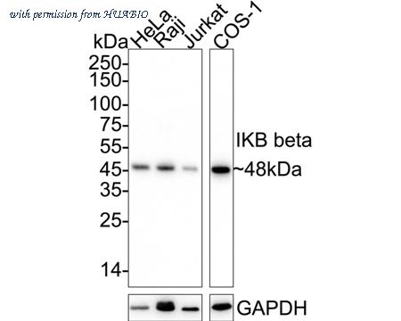 HUABIO ET1611-1 image 1