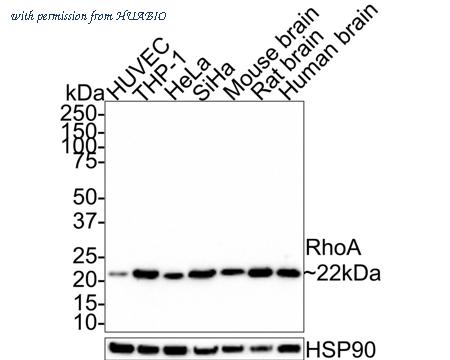 HUABIO ET1611-10 image 1