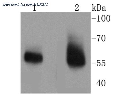 HUABIO ET1611-11 image 1