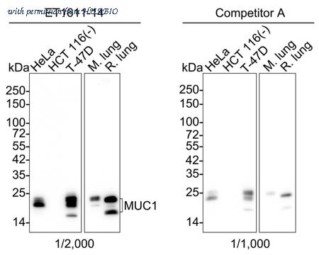 HUABIO ET1611-14-50UL image 1