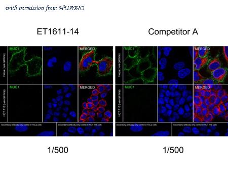 HUABIO ET1611-14-50UL image 2