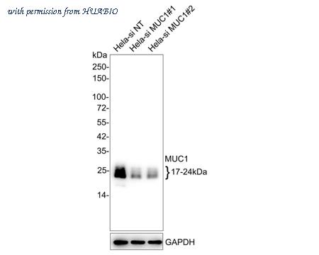 HUABIO ET1611-14-50UL image 3