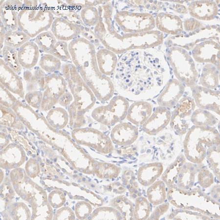 HUABIO ET1611-15 image 2