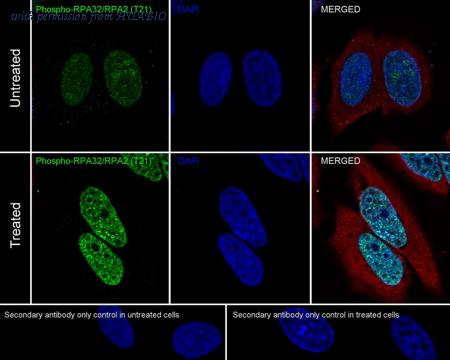 HUABIO ET1611-18 image 2