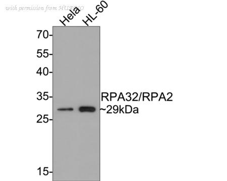 HUABIO ET1611-18 image 3