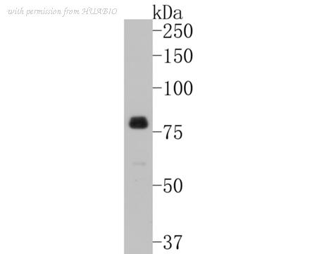 HUABIO ET1611-26 image 1