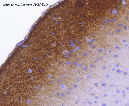 HUABIO ET1611-26 image 2