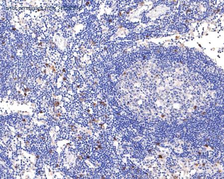 HUABIO ET1611-27 image 2