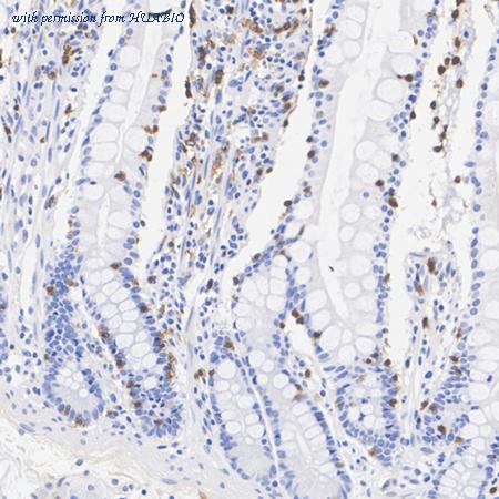 HUABIO ET1611-27 image 3