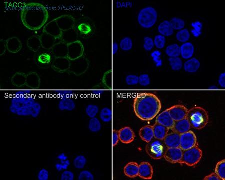 HUABIO ET1611-34 image 2