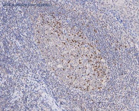 HUABIO ET1611-35 image 3