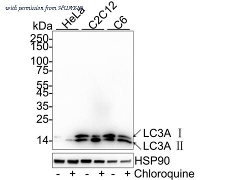 HUABIO ET1611-37 image 1