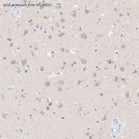 HUABIO ET1611-37 image 2