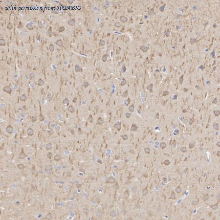 HUABIO ET1611-37 image 3