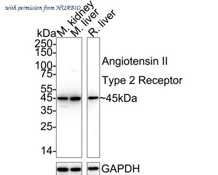 HUABIO ET1611-41 image 1