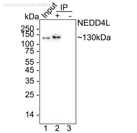 HUABIO ET1611-42 image 3