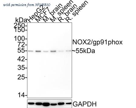 HUABIO ET1611-44 image 1