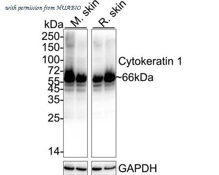 HUABIO ET1611-46 image 1