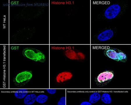 HUABIO ET1611-47 image 3
