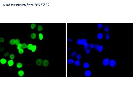 HUABIO ET1611-48 image 1