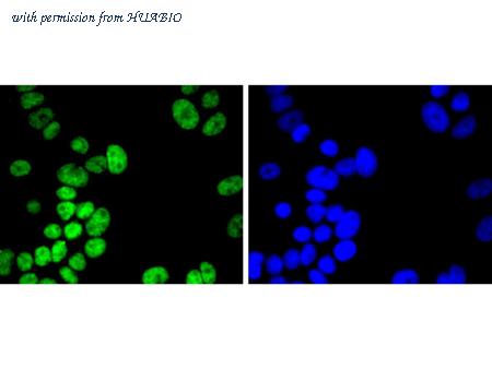 HUABIO ET1611-48 image 3