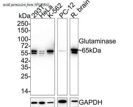 HUABIO ET1611-5 image 1