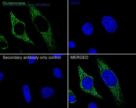 HUABIO ET1611-5 image 2