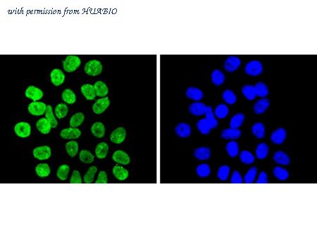 HUABIO ET1611-51 image 2